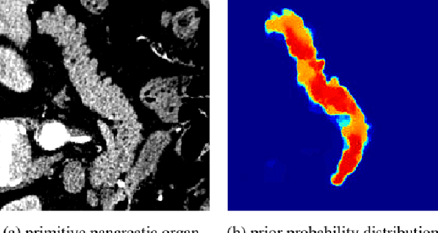 Figure 2 for Diffusion Probabilistic Multi-cue Level Set for Reducing Edge Uncertainty in Pancreas Segmentation