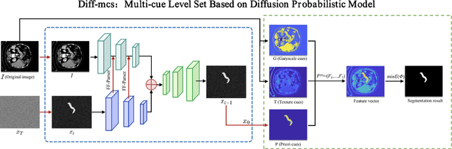 Figure 3 for Diffusion Probabilistic Multi-cue Level Set for Reducing Edge Uncertainty in Pancreas Segmentation