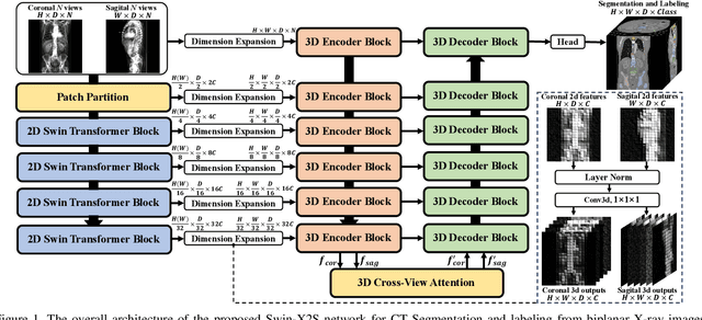 Figure 1 for Swin-X2S: Reconstructing 3D Shape from 2D Biplanar X-ray with Swin Transformers