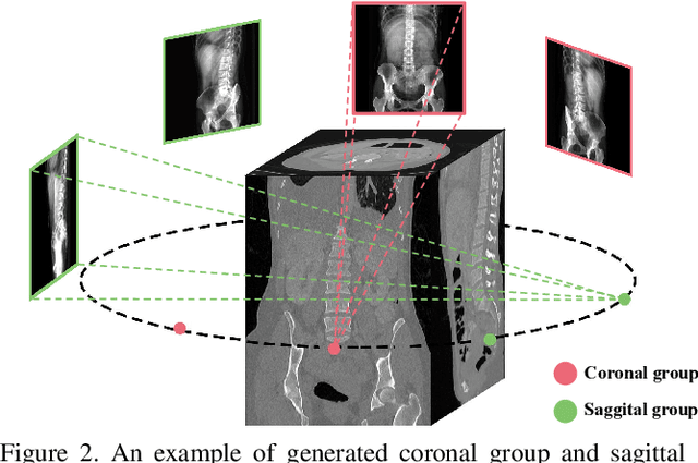 Figure 3 for Swin-X2S: Reconstructing 3D Shape from 2D Biplanar X-ray with Swin Transformers