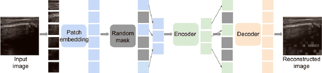 Figure 1 for Self-supervised TransUNet for Ultrasound regional segmentation of the distal radius in children