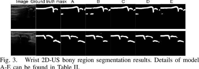 Figure 3 for Self-supervised TransUNet for Ultrasound regional segmentation of the distal radius in children