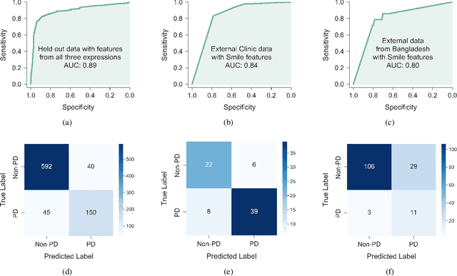 Figure 4 for Unmasking Parkinson's Disease with Smile: An AI-enabled Screening Framework