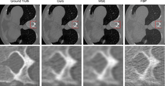 Figure 2 for Data-Driven Filter Design in FBP: Transforming CT Reconstruction with Trainable Fourier Series