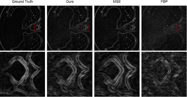 Figure 3 for Data-Driven Filter Design in FBP: Transforming CT Reconstruction with Trainable Fourier Series