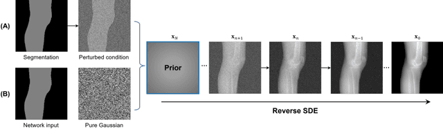 Figure 1 for Segmentation-Guided Knee Radiograph Generation using Conditional Diffusion Models