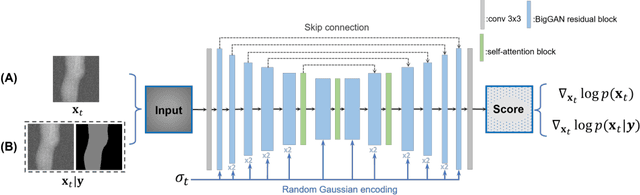 Figure 2 for Segmentation-Guided Knee Radiograph Generation using Conditional Diffusion Models