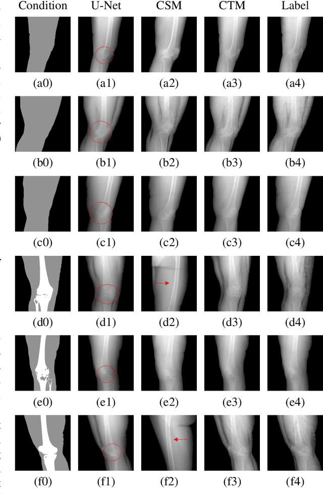 Figure 3 for Segmentation-Guided Knee Radiograph Generation using Conditional Diffusion Models