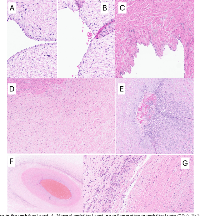 Figure 1 for Deep Learning for Fetal Inflammatory Response Diagnosis in the Umbilical Cord