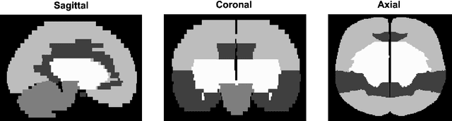 Figure 1 for Meta-Analysis of Transfer Learning for Segmentation of Brain Lesions