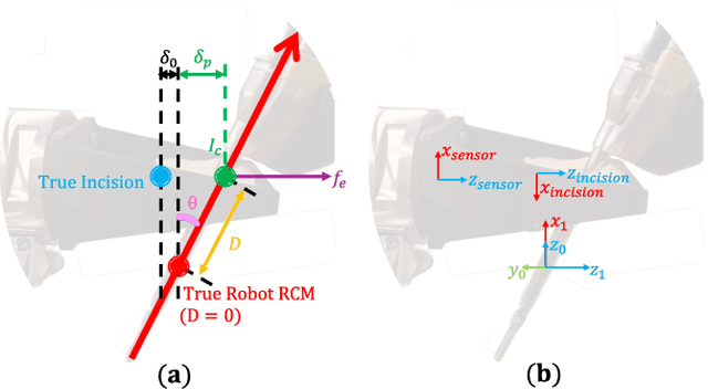Figure 2 for Sensorless Remote Center of Motion Misalignment Estimation