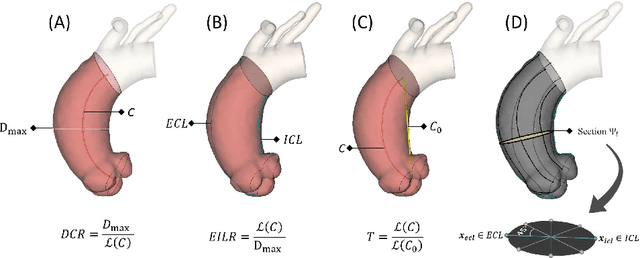 Figure 4 for Computer-aided shape features extraction and regression models for predicting the ascending aortic aneurysm growth rate