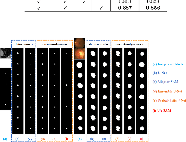 Figure 3 for Uncertainty-Aware Adapter: Adapting Segment Anything Model (SAM) for Ambiguous Medical Image Segmentation