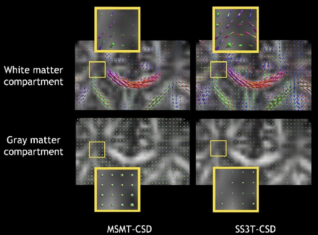 Figure 3 for Ground-truth effects in learning-based fiber orientation distribution estimation in neonatal brains