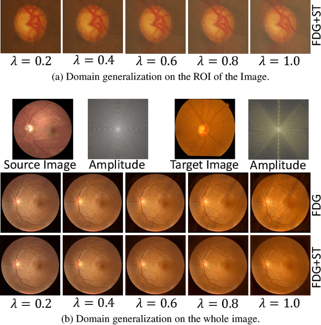Figure 3 for Domain Generalization with Fourier Transform and Soft Thresholding