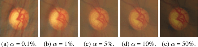 Figure 4 for Domain Generalization with Fourier Transform and Soft Thresholding