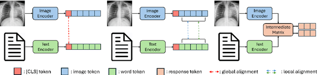 Figure 4 for Automatic Medical Report Generation: Methods and Applications