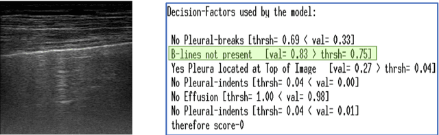 Figure 4 for Improving Model's Interpretability and Reliability using Biomarkers