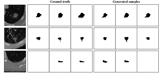 Figure 1 for Stochastic Segmentation with Conditional Categorical Diffusion Models