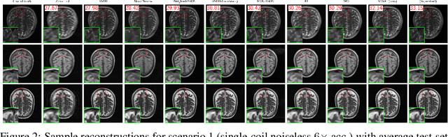 Figure 2 for Benchmarking Self-Supervised Methods for Accelerated MRI Reconstruction