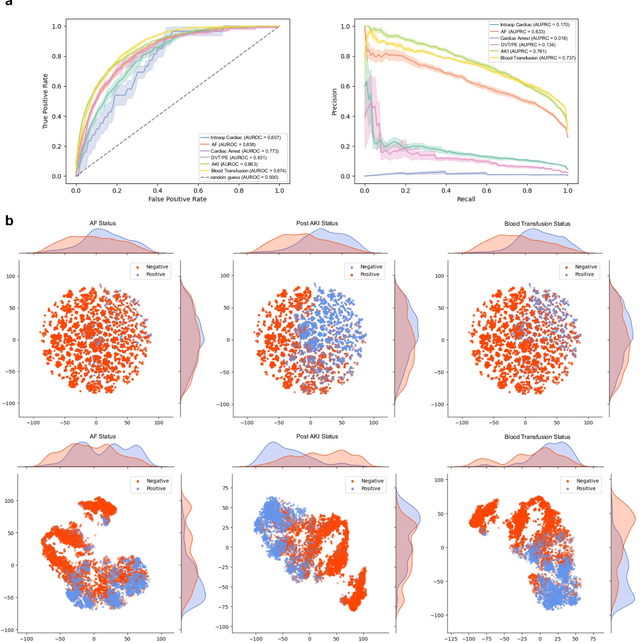 Figure 3 for A Novel Generative Multi-Task Representation Learning Approach for Predicting Postoperative Complications in Cardiac Surgery Patients