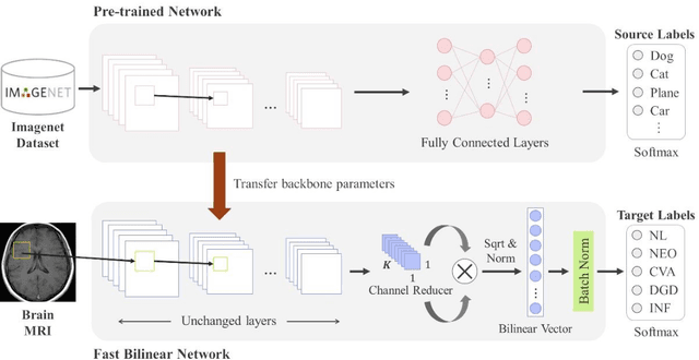 Figure 1 for Lite-FBCN: Lightweight Fast Bilinear Convolutional Network for Brain Disease Classification from MRI Image