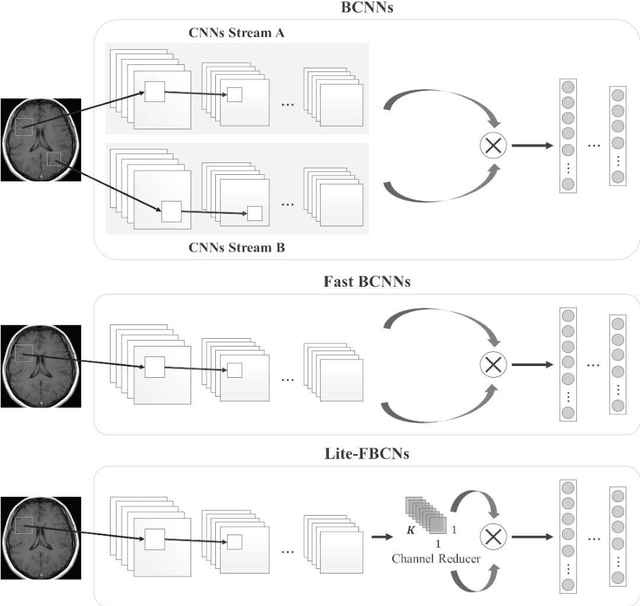 Figure 3 for Lite-FBCN: Lightweight Fast Bilinear Convolutional Network for Brain Disease Classification from MRI Image