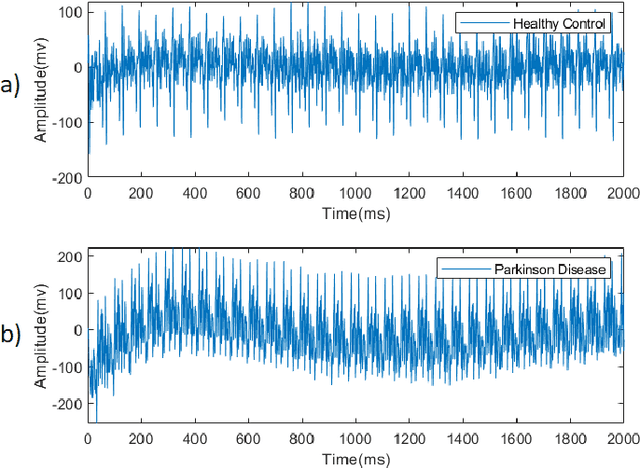 Figure 1 for Diagnosis of Parkinson's Disease Using EEG Signals and Machine Learning Techniques: A Comprehensive Study