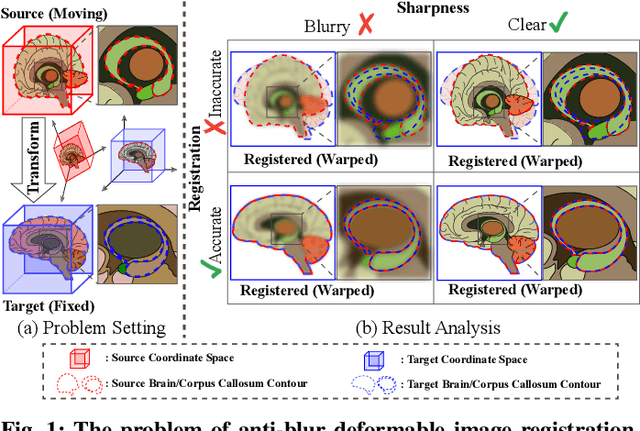 Figure 1 for ABN: Anti-Blur Neural Networks for Multi-Stage Deformable Image Registration