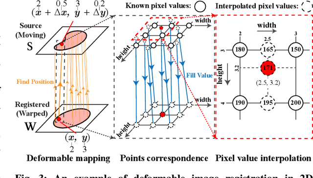 Figure 4 for ABN: Anti-Blur Neural Networks for Multi-Stage Deformable Image Registration