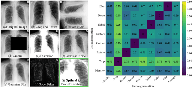 Figure 3 for Exploring Image Augmentations for Siamese Representation Learning with Chest X-Rays