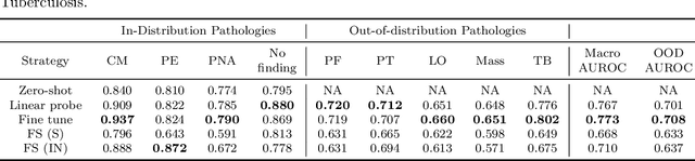 Figure 4 for Exploring Image Augmentations for Siamese Representation Learning with Chest X-Rays