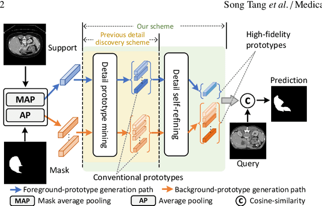 Figure 1 for Few-Shot Medical Image Segmentation with High-Fidelity Prototypes