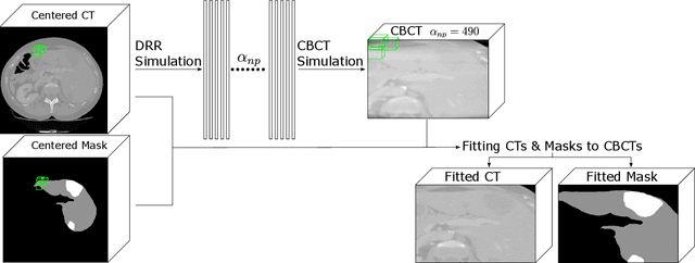 Figure 1 for CBCTLiTS: A Synthetic, Paired CBCT/CT Dataset For Segmentation And Style Transfer