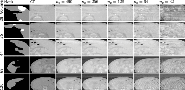 Figure 2 for CBCTLiTS: A Synthetic, Paired CBCT/CT Dataset For Segmentation And Style Transfer