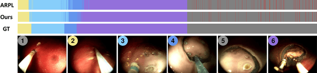 Figure 3 for OSSAR: Towards Open-Set Surgical Activity Recognition in Robot-assisted Surgery