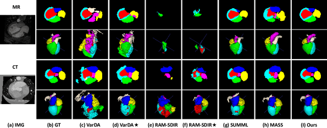 Figure 4 for Double Banking on Knowledge: Customized Modulation and Prototypes for Multi-Modality Semi-supervised Medical Image Segmentation