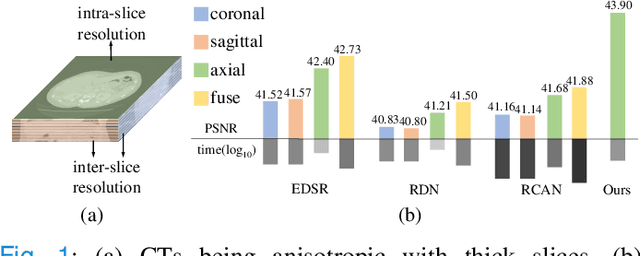 Figure 1 for I$^3$Net: Inter-Intra-slice Interpolation Network for Medical Slice Synthesis