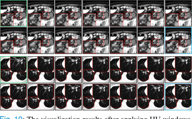 Figure 2 for I$^3$Net: Inter-Intra-slice Interpolation Network for Medical Slice Synthesis