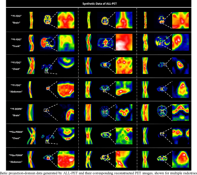 Figure 1 for ALL-PET: A Low-resource and Low-shot PET Foundation Model in the Projection Domain