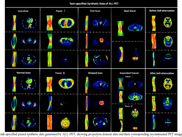 Figure 2 for ALL-PET: A Low-resource and Low-shot PET Foundation Model in the Projection Domain
