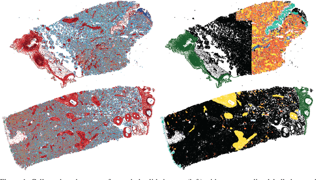 Figure 2 for A New Graph Node Classification Benchmark: Learning Structure from Histology Cell Graphs