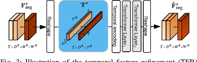 Figure 4 for Continuous Urban Change Detection from Satellite Image Time Series with Temporal Feature Refinement and Multi-Task Integration