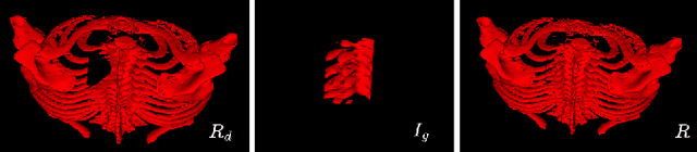 Figure 1 for RibCageImp: A Deep Learning Framework for 3D Ribcage Implant Generation