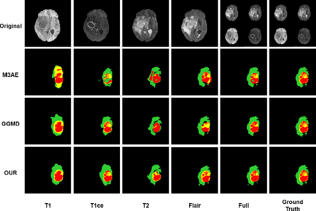 Figure 2 for Robust Divergence Learning for Missing-Modality Segmentation