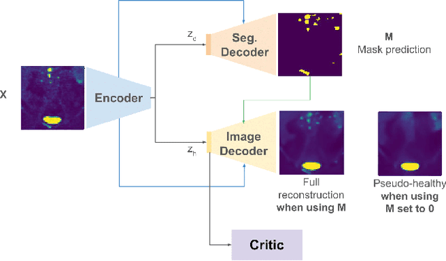 Figure 1 for Disentangled PET Lesion Segmentation