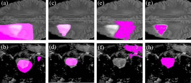 Figure 1 for BoundaryCAM: A Boundary-based Refinement Framework for Weakly Supervised Semantic Segmentation of Medical Images