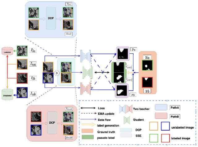 Figure 1 for Dual-Teacher Ensemble Models with Double-Copy-Paste for 3D Semi-Supervised Medical Image Segmentation