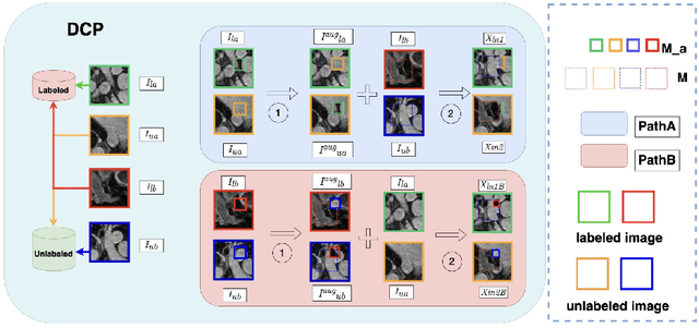 Figure 3 for Dual-Teacher Ensemble Models with Double-Copy-Paste for 3D Semi-Supervised Medical Image Segmentation