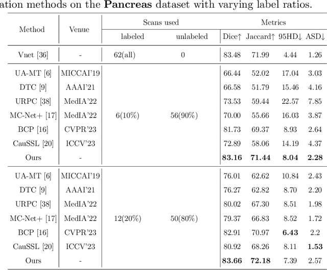 Figure 4 for Dual-Teacher Ensemble Models with Double-Copy-Paste for 3D Semi-Supervised Medical Image Segmentation